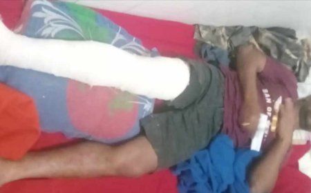 রাস্তা থেকে ধরে নিয়ে পা ভেঙ্গে দেওয়ার অভিযোগ মেম্বারের বিরুদ্ধে 