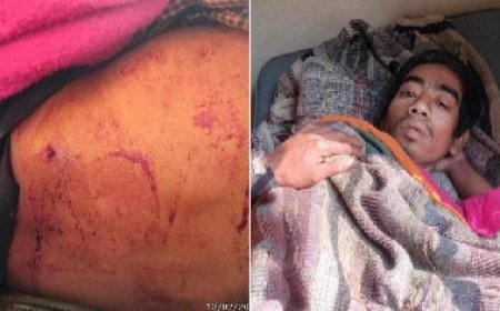 রুমায় একজনকে গুলির ঘটনায় বম ও মারমাদের মধ্যে উত্তেজনা নিরসনের আহবান