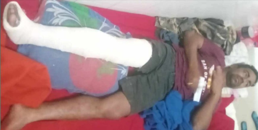 রাস্তা থেকে ধরে নিয়ে পা ভেঙ্গে দেওয়ার অভিযোগ মেম্বারের বিরুদ্ধে