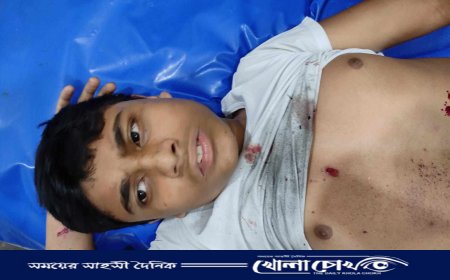 পটকা বিস্ফোরণে উড়ে গেল মাদ্রাসা ছাত্রের হাতের আঙ্গুল