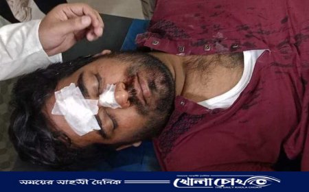 কক্সবাজারে সাংবাদিক মিজানুর রহমানের উপর হামলা,দোষীদের শাস্তি দাবি 