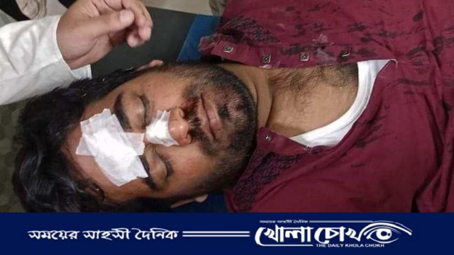 কক্সবাজারে সাংবাদিক মিজানুর রহমানের উপর হামলা,দোষীদের শাস্তি দাবি