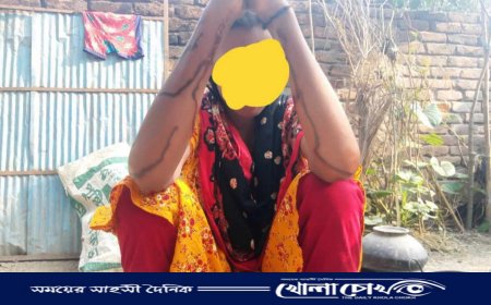 মিঠাপুকুরে সাজানো ধর্ষণ মামলার পর এবার সাজানো এসিড নিক্ষেপের অভিযোগ