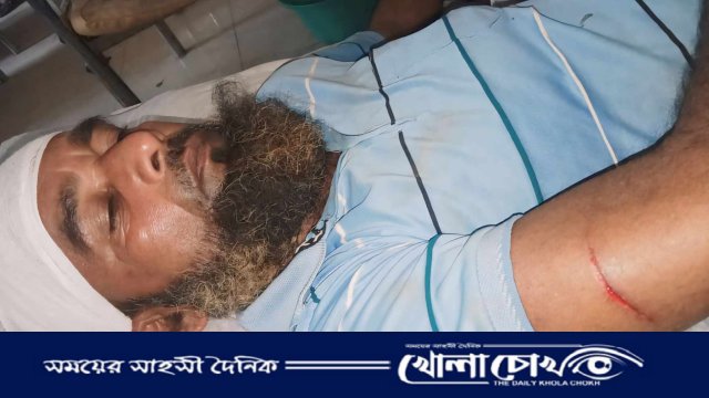 জমিজমা সংক্রান্ত বিরোধের জেরে প্রকাশ্যে ছুরি দিয়ে হত্যা চেষ্টার অভিযোগ