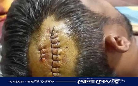 নোয়াখালীতে কুড়াল দিয়ে কোপিয়ে কৃষককে হত্যা