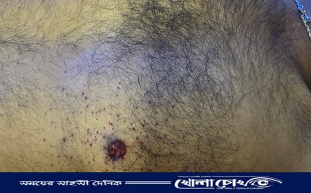 সোনাইমুড়ীতে যুবককে গুলি করে হত্যা