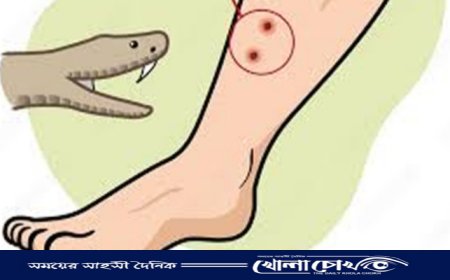 নোয়াখালীতে এবার সাপের দংশনে হাসপাতালে ২৫৫ জন
