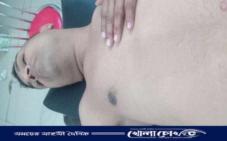 নোয়াখালীতে চুরির দ্বন্দ্বে অ্যাম্বুলেন্স চালককে ছুরিকাঘাতে হত্যা  