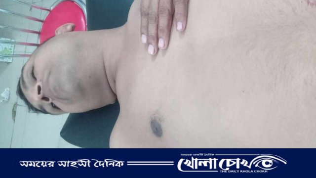 নোয়াখালীতে চুরির দ্বন্দ্বে অ্যাম্বুলেন্স চালককে ছুরিকাঘাতে হত্যা