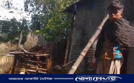 ভাঙ্গায় আগুনে পুড়ে মৃত্যুর সঙ্গে পাঞ্জা লড়ছে দুই শিশুঃ বার্ন ইউনিটে প্রেরণ 