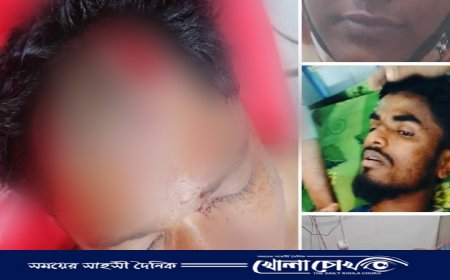 লামায় পৃথক সংঘর্ষে ১৫ জন আহত, লুটপাটের অভিযোগ