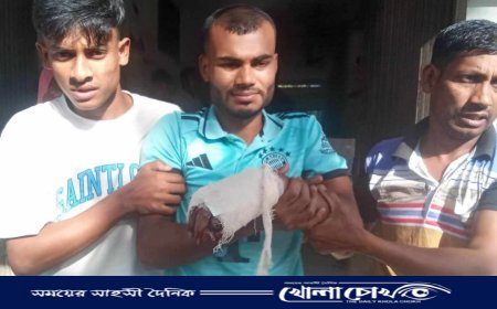 বাঘায় বোমা বিস্ফোরণে কলেজছাত্রের হাতের কবজি বিচ্ছিন্ন