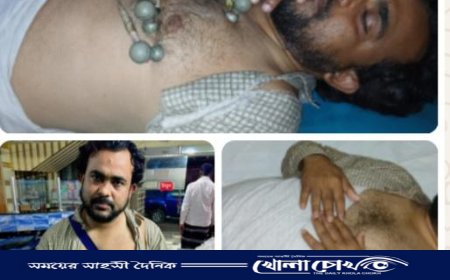 শিবচরে সংবাদ প্রচারের জেরে সাংবাদিকের উপর সন্ত্রাসী হামলা