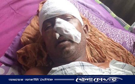 শ্রীনগরে ফল বিক্রেতাকে কুপিয়ে টাকা ছিনতাই