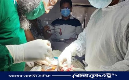 ফুলবাড়িয়ায় উপজেলা হাসপাতালে প্রথমবারের মতো পিত্তথলির পাথর অপারেশন