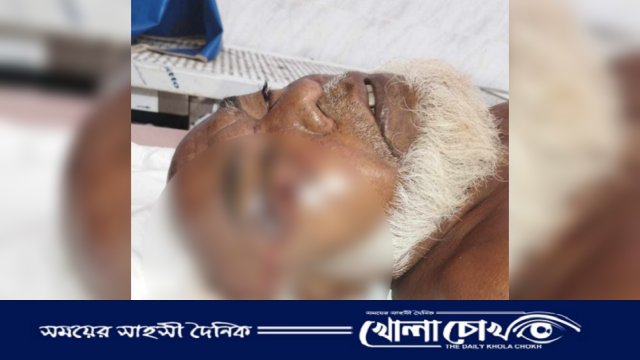 নোয়াখালীতে গাছের ঢাল কাটাকে কেন্দ্র করে বৃদ্ধাকে পিটিয়ে হত্যা