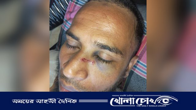 বরিশালের আগৈলঝাড়ায় চাঁদা না পেয়ে শিক্ষকের ওপর হামলা, মামলা দায়ের