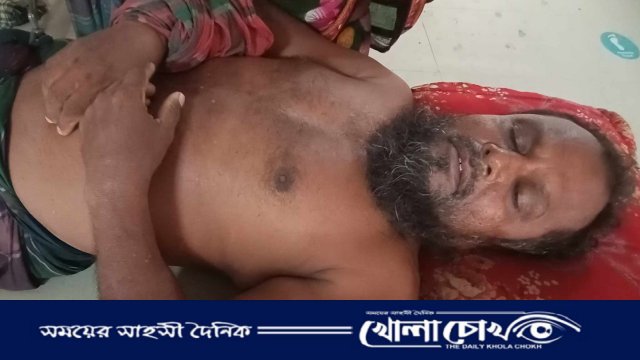 পূর্ব শত্রুতার জেরে কৃষককে পিটিয়ে দুই হাত ভেঙে দেওয়া, থানায় অভিযোগ