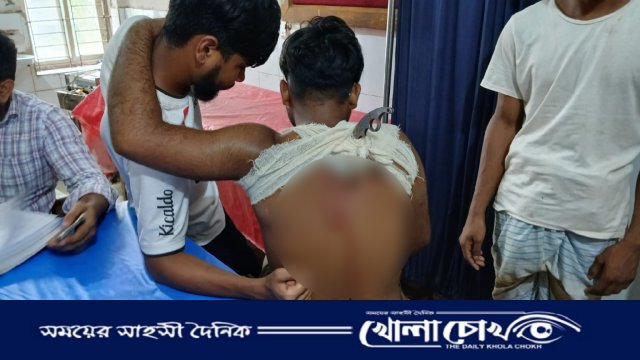 শ্রীনগরে মাদক সেবনে বাধা, সুইচগিয়ারের আঘাতে যুবক গুরুতর আহত