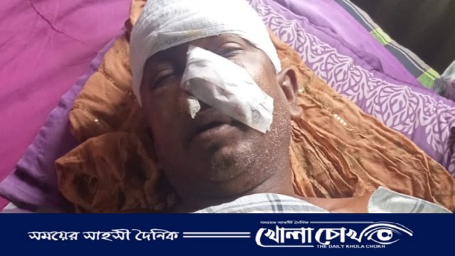 শ্রীনগরে ফল বিক্রেতাকে কুপিয়ে টাকা ছিনতাই