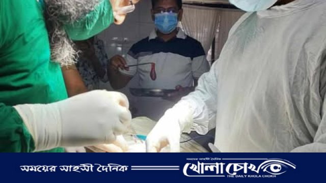 ফুলবাড়িয়ায় উপজেলা হাসপাতালে প্রথমবারের মতো পিত্তথলির পাথর অপারেশন