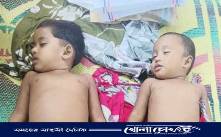 ব্রাহ্মণবাড়িয়ায় পুকুরে ডুবে দুই শিশুর মর্মান্তিক মৃত্যু