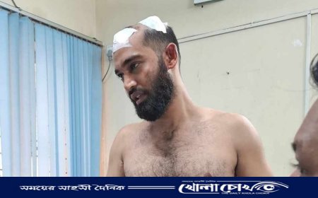 কোম্পানীগঞ্জে অতিরিক্ত ভাড়া নেওয়ার প্রতিবাদে শিক্ষানবিশ আইনজীবীকে পিটিয়ে রক্তাক্ত