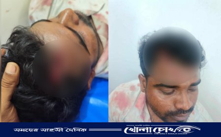 শ্রীনগরে জমিজমা নিয়ে পূর্ব শত্রুতার জেরে প্রবাসীর ওপর সন্ত্রাসী হামলা