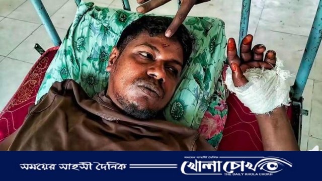 মাগুরার শ্রীপুরে শিয়ালের কামড়ে যুবক আহত