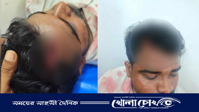 শ্রীনগরে জমিজমা নিয়ে পূর্ব শত্রুতার জেরে প্রবাসীর ওপর সন্ত্রাসী হামলা