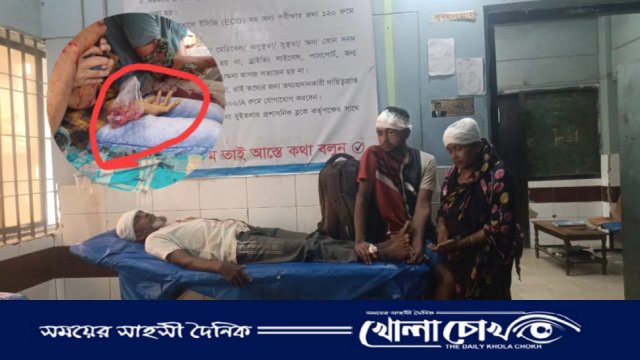 বিজয়নগরে ছেলের দায়ের কোপে বাবার হাত বিচ্ছিন্ন