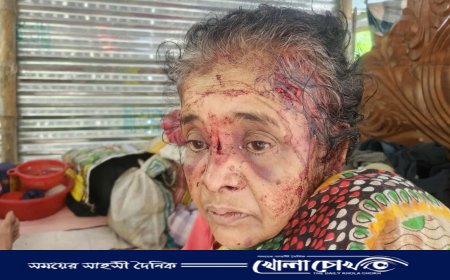 ঝালকাঠিতে ৭৫ বছর বয়সী বৃদ্ধাকে হত্যার চেষ্টা: আতঙ্কিত এলাকাবাসী
