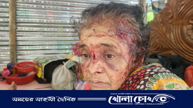 ঝালকাঠিতে ৭৫ বছর বয়সী বৃদ্ধাকে হত্যার চেষ্টা: আতঙ্কিত এলাকাবাসী