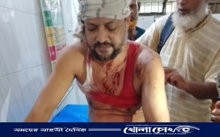 পিরোজপুরে চুরির সন্দেহে ব্যবসায়ীকে হাতুড়ি দিয়ে পিটিয়ে জখম