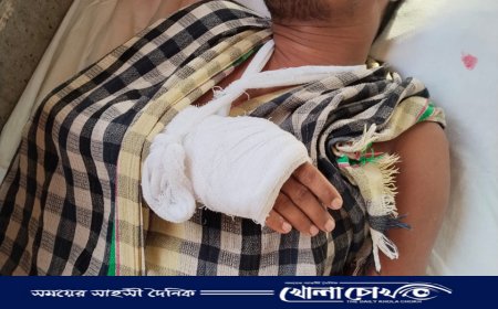 ইন্দুরকানীতে তুচ্ছ ঘটনায় ছাত্রদল নেতার দুই হাত ভাঙল প্রতিপক্ষের হামলায়