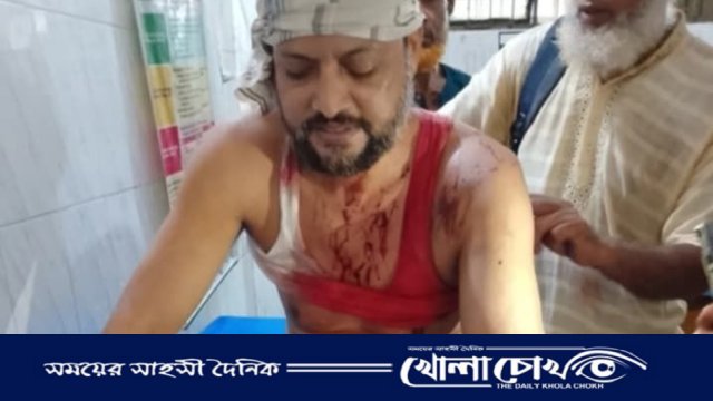 পিরোজপুরে চুরির সন্দেহে ব্যবসায়ীকে হাতুড়ি দিয়ে পিটিয়ে জখম