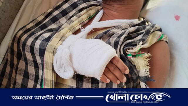 ইন্দুরকানীতে তুচ্ছ ঘটনায় ছাত্রদল নেতার দুই হাত ভাঙল প্রতিপক্ষের হামলায়