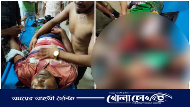 মাদক-বিরোধের জেরে যুবককে কুপিয়ে পায়ের পাঁচ আঙুল বিচ্ছিন্ন