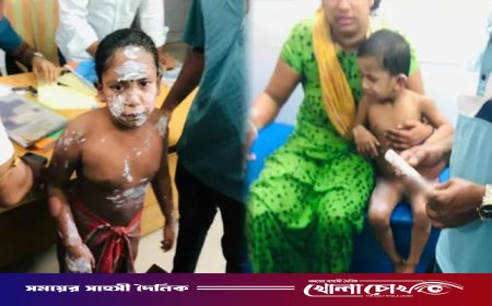 নোয়াখালীতে গ্যাস লিকেজ থেকে বিস্ফোরণে একই পরিবারের ৪জন দগ্ধ