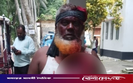 শ্রীনগরে জমি বিরোধে প্রতিপক্ষের হামলায় নারীসহ আহত ২