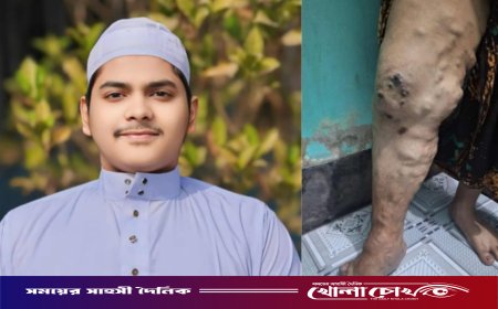 ব্রাহ্মণবাড়িয়ায় বিরল রোগে আক্রান্ত মাদরাসা ছাত্র নাজমুল