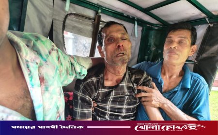 ইন্দুরকানীতে সুপারি পাড়াকে কেন্দ্র করে পারিবারিক বিরোধে চাচা গুরুতর আহত