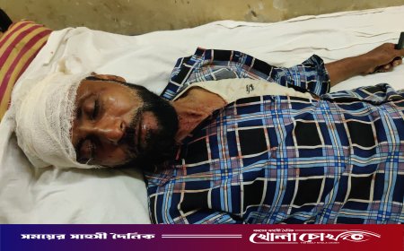 ফরিদপুরের নগরকান্দায় স্বামীকে কুপিয়ে আহত