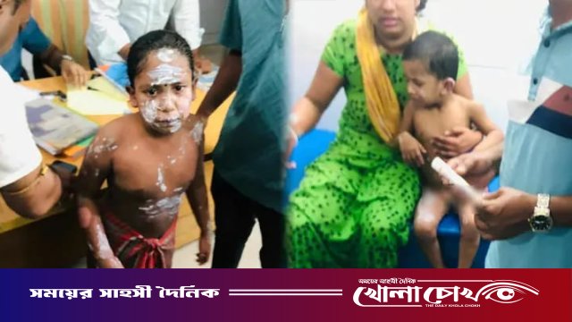 নোয়াখালীতে গ্যাস লিকেজ থেকে বিস্ফোরণে একই পরিবারের ৪জন দগ্ধ
