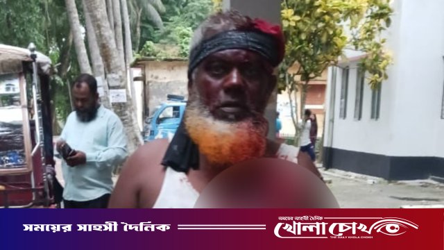 শ্রীনগরে জমি বিরোধে প্রতিপক্ষের হামলায় নারীসহ আহত ২