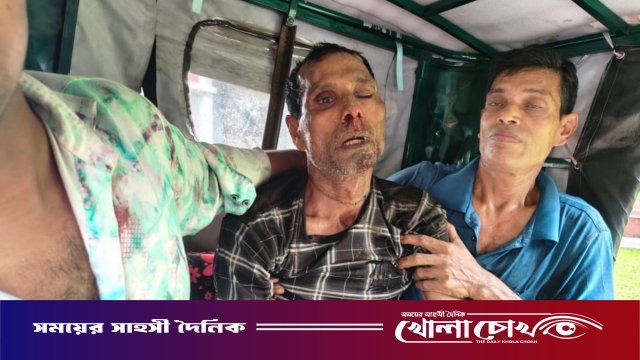 ইন্দুরকানীতে সুপারি পাড়াকে কেন্দ্র করে পারিবারিক বিরোধে চাচা গুরুতর আহত