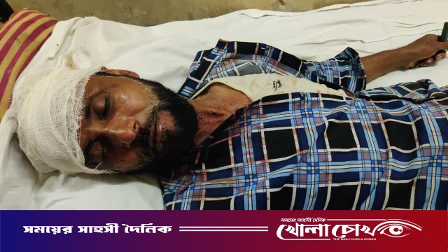 ফরিদপুরের নগরকান্দায় স্বামীকে কুপিয়ে আহত