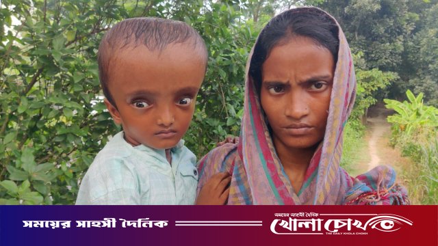 যে কাঁধে থাকার কথা আদরের চুম্বন, সে কাঁধেই এখন অসুস্থ সন্তানের দুঃসহ ভার