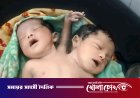 নওগাঁয় দুই মাথা ও তিন হাতওয়ালা শিশুর জন্ম, এক ঘণ্টার মধ্যেই মৃত্যুর হার