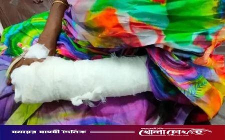 ছিনতাইকারীর হামলায় গুরুতর আহত কুবি শিক্ষার্থীর মা